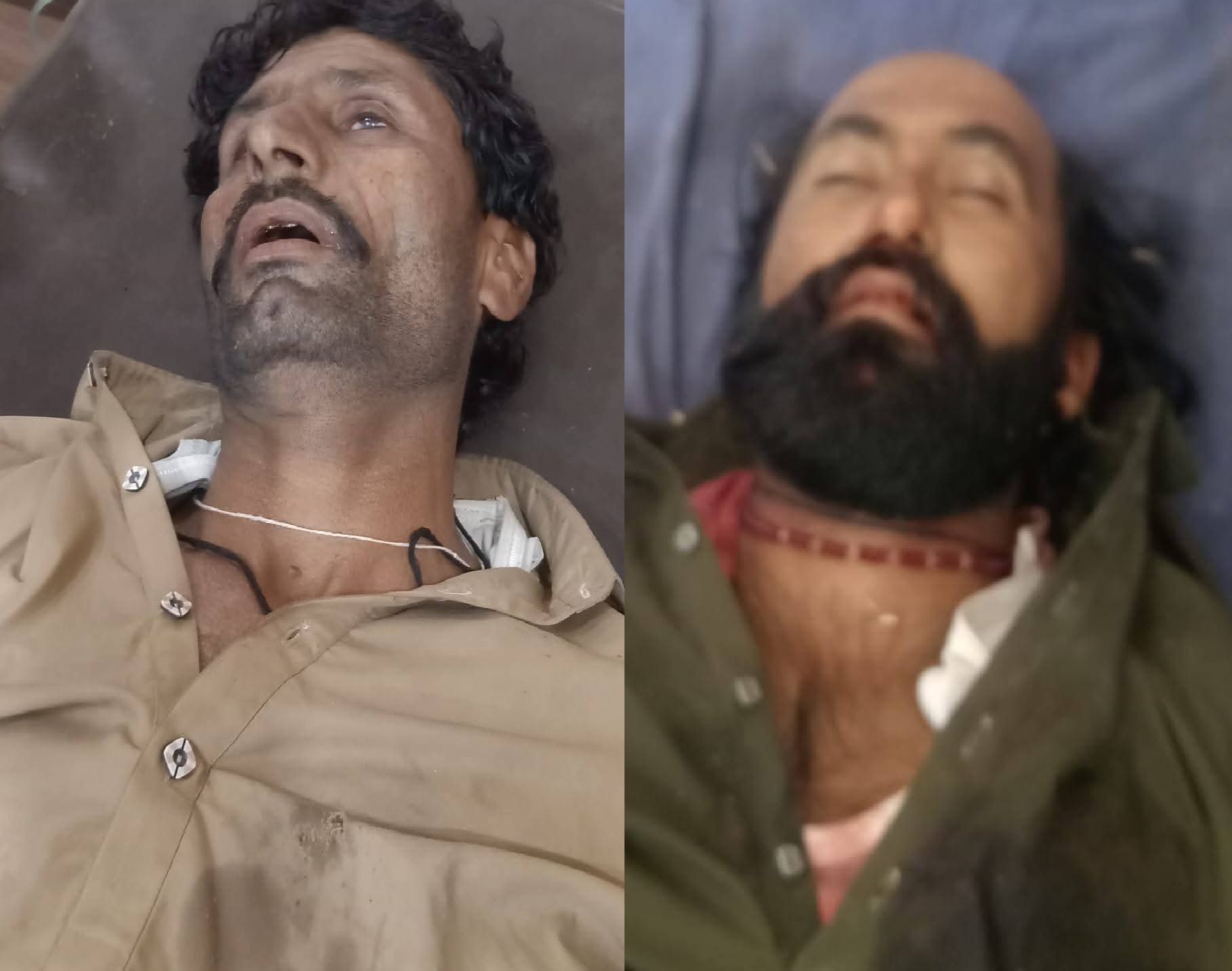 ٺٽي ويجهو معمولي تڪرار ٻن سگن ڀائرن جون حياتيون کسي ورتيون