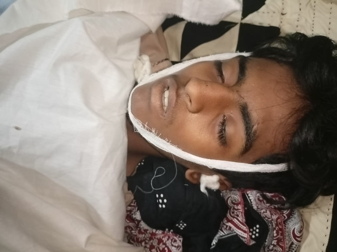 Tando Adam: Minor Boy Crushed to Death After Collision with Buffalo, Area in Shock