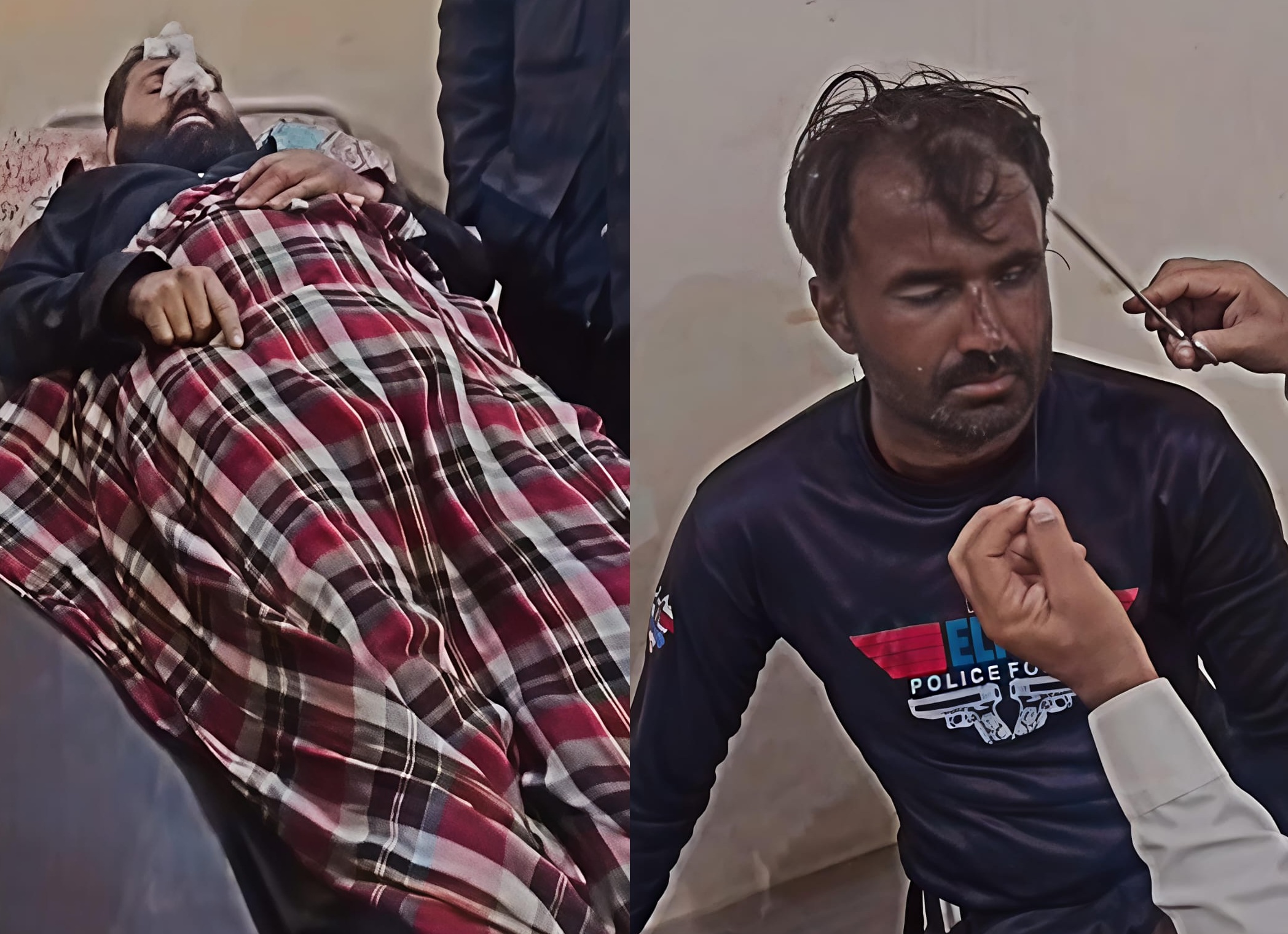 Four Police Officers Injured in High-Speed Chase Accident