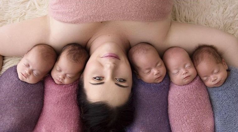 کراچی میں خاتون نے ایک ہی وقت میں 5 بچوں کو جنم دیا