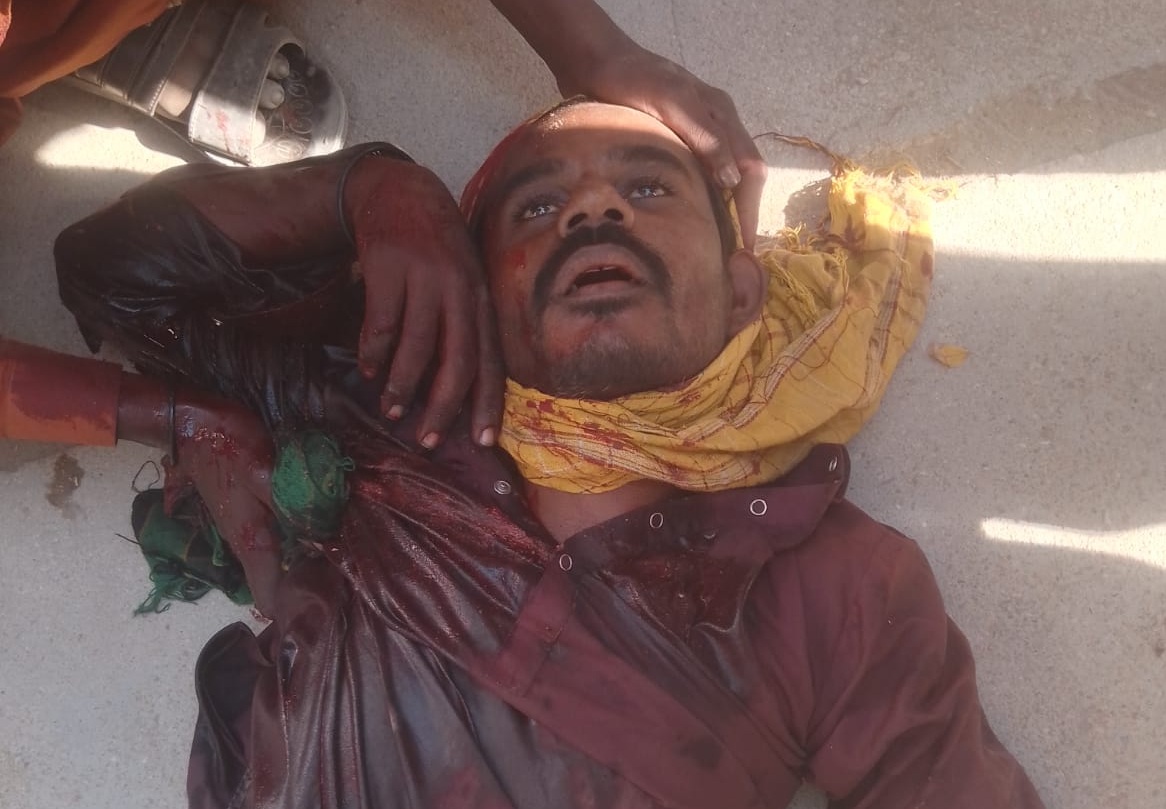 گهگهر ۾ ڪٻاڙ جي دڪان تي ڪم ڪندڙ پورهيت گئس سلينڊر سبب فوت