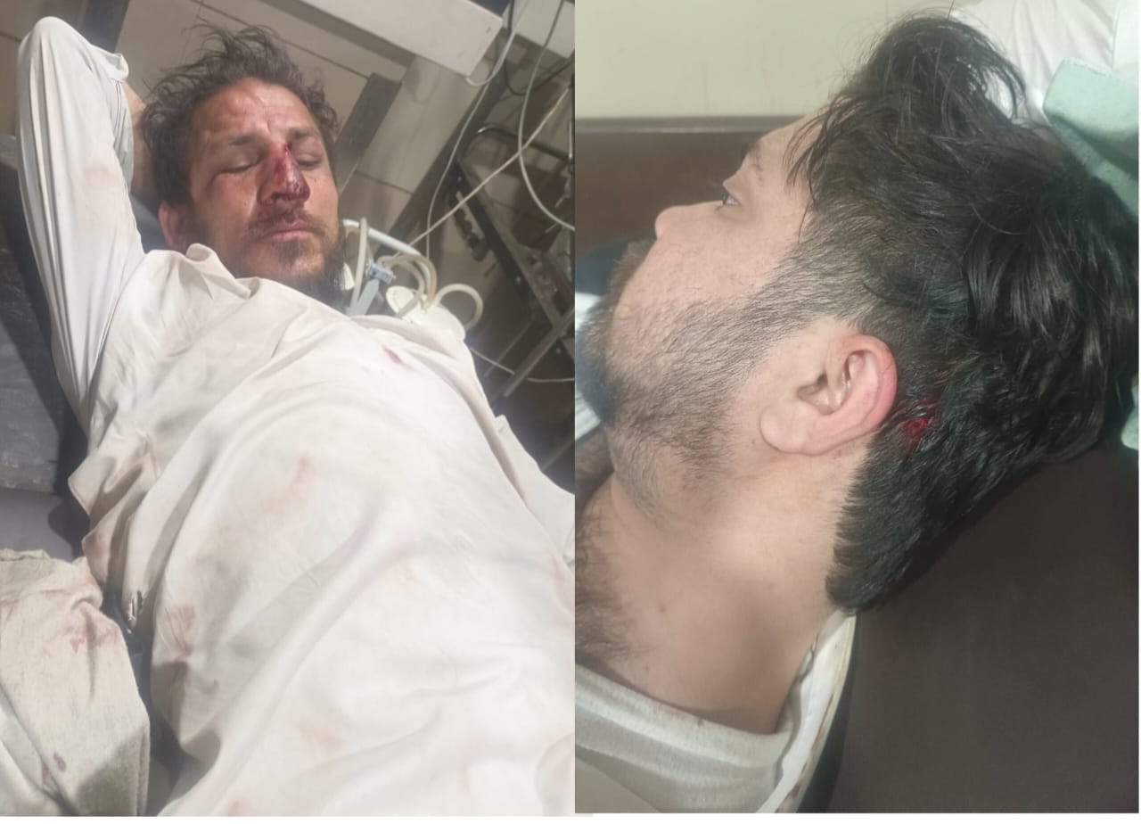 ملير يو سي چشما جي چيئرمين عمران يوسفزئي تي مبينا حملو، پٽ ۽ سؤٽ زخمي