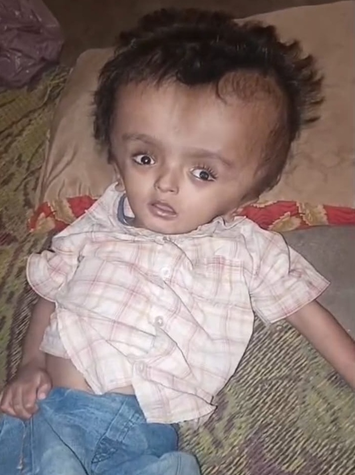 ملير واسي پورهيت جو معصوم پٽ دماغي بيماري ۾ مبتلا