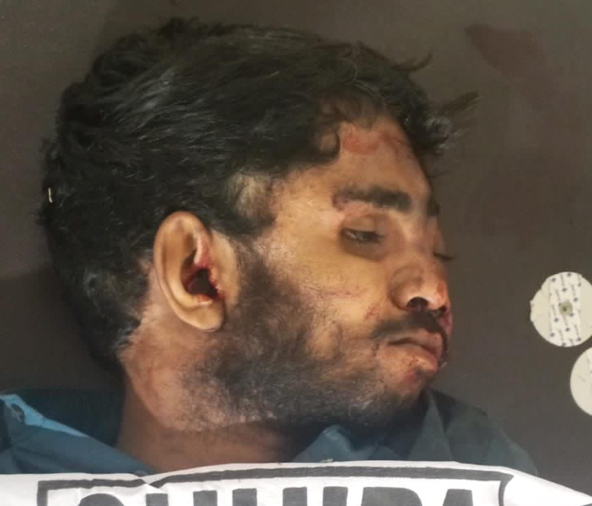 ملير: اسپتال چورنگي ويجهو افسوسناڪ حادثو، 2 ڄڻا حياتيون وڃائي ويٺا