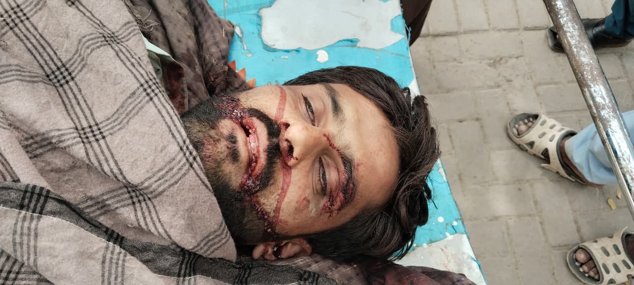 پڊعيدن ٿاڻي جي حد ۾ ھٿياربندن جي فائرنگ ۾ نوجوان دڪاندار قتل